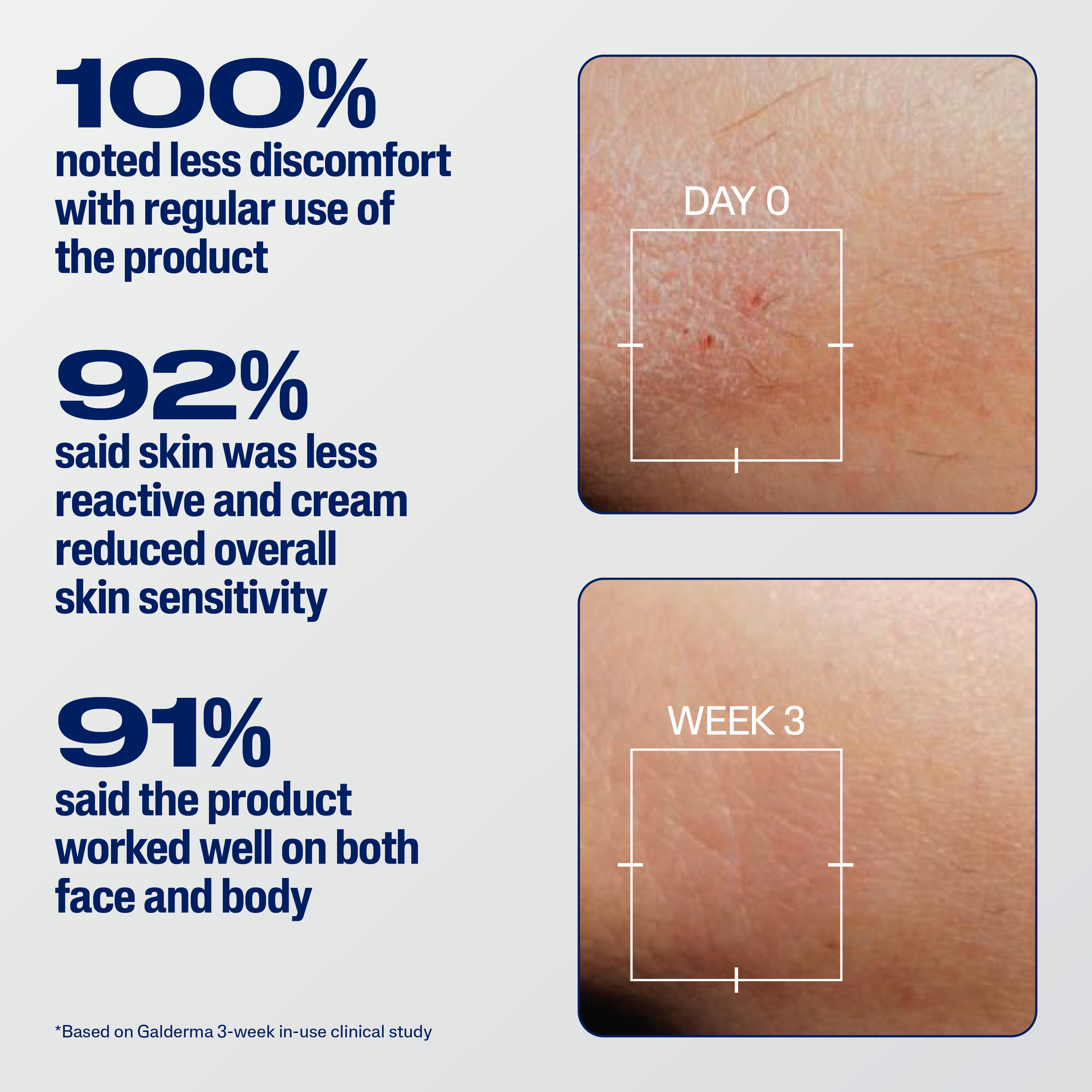 Cetaphil Pro Eczema Soothe & Repair Cream