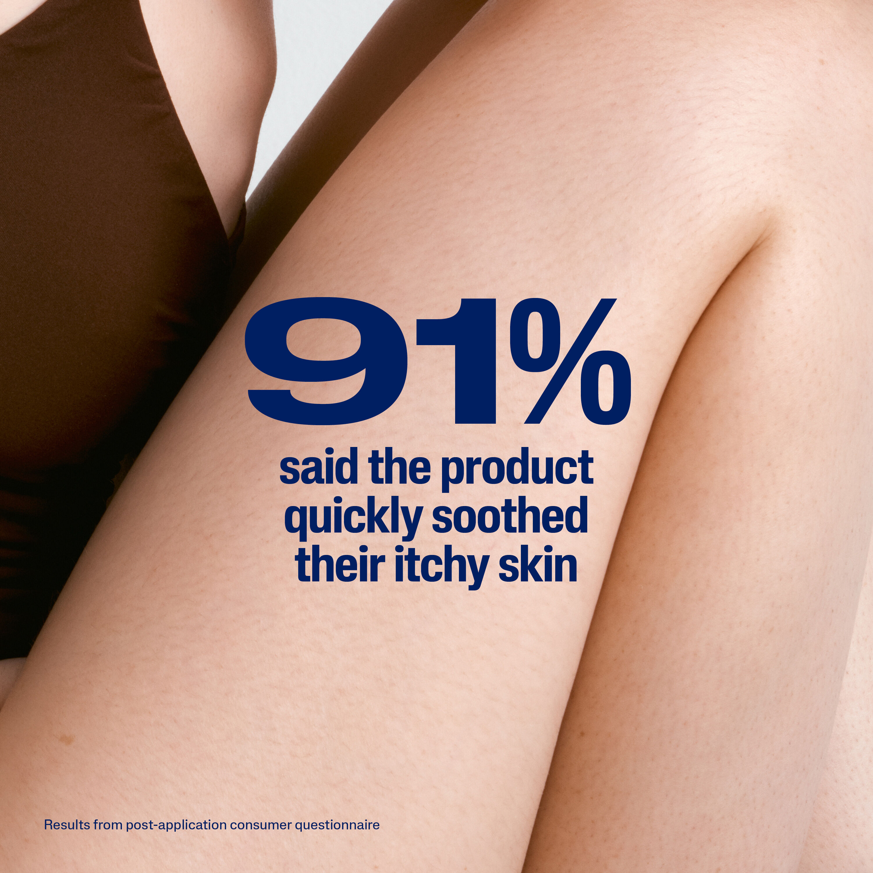 PRO Eczema Prone Itch Relief Gel
